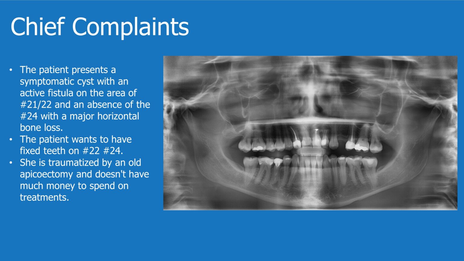 Horizontal Bone Augmentation - Immediate Implant Placement - Augma ...