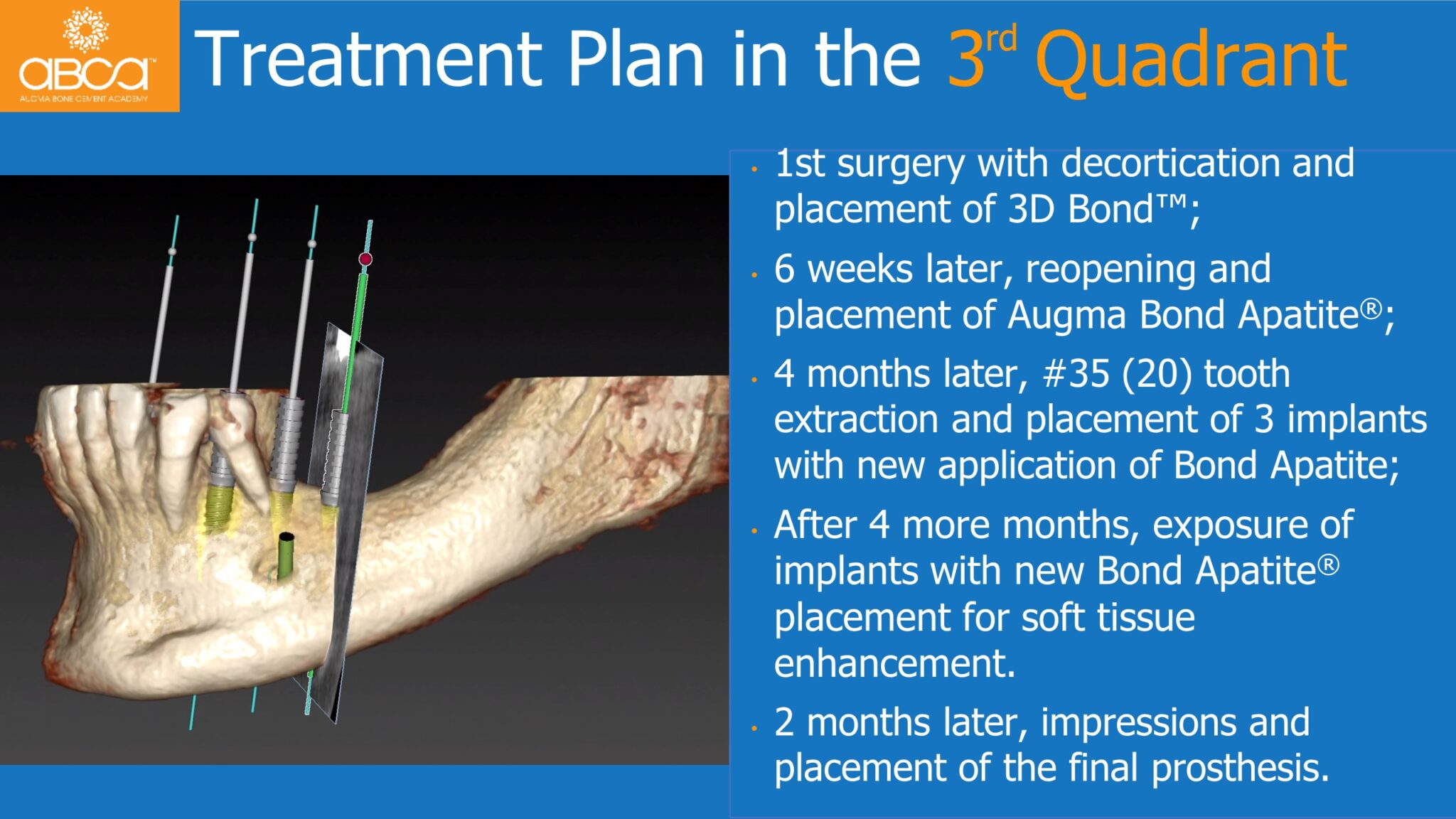 Horizontal Bone and Soft Tissue Augmentation with Augma Bond Apatite ...