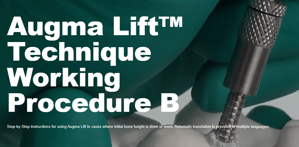 Augma Lift Complete Working Procedure – Scenario B - Augma Biomaterials
