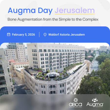 Augma Day Jerusalem