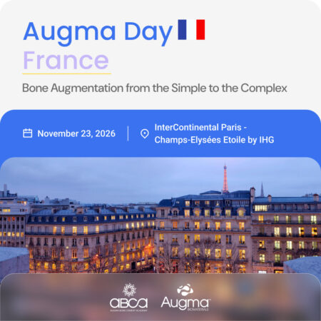 Augma Day France