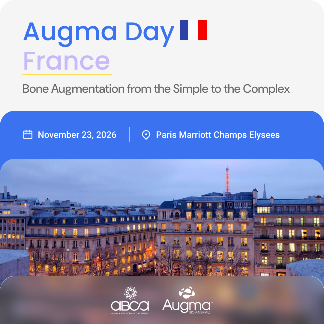 Augma Day France